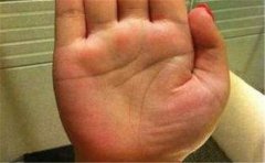 手掌纹细浅代表什么意思？不同的掌纹寓意不同