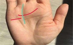 小孩两手掌纹不一样不用担心，是正常情况