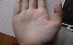 掌纹中间的竖线不是人人有，有了也可能不好