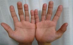 右手掌纹有个叉的人财运好，这些手相之人也是