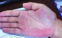 一个人要是有情路坎坷的手相会有哪些特征