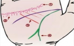 左手诊断健康,这些特征不要忽视,不然后果严