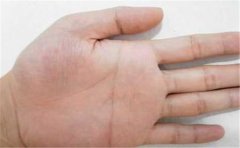 这些是劳碌的手相，运势不佳，希望你没有