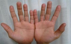 女人手相图解，婚后容易出现危机的手相分析