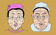 痣相图解分析无名指痣相，这个痣相比较少见