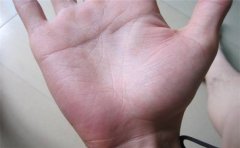 老师对手相的链条出现位置分析