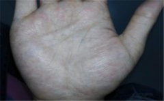 分析如何看手相，手中的很多特征都可以观察