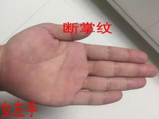 双手断掌的人罕见吗 两只手都是断掌的男孩