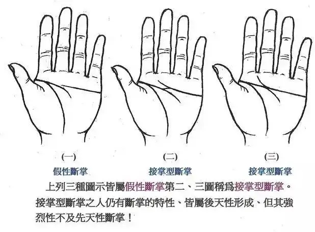 手相断掌是什么意思 手相断掌是什么意思图解