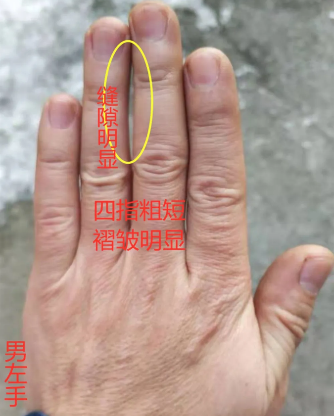 免费拍照看手相算命在线 算命免费 生辰八字 婚姻