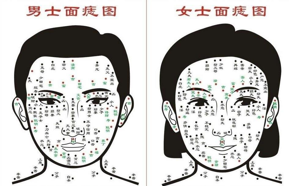 痣代表什么图解 太田痣是什么样子图片